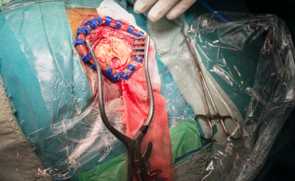 Invisalign and Orthodontic Care