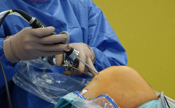 Invisalign and Orthodontic Care